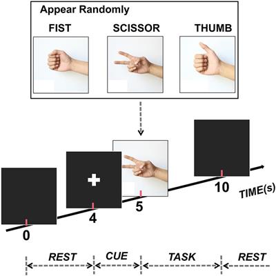 Investigating Data Cleaning Methods to Improve Performance of Brain–Computer Interfaces Based on Stereo-Electroencephalography